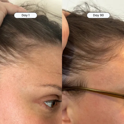 Curescalp™ Hair Revival System