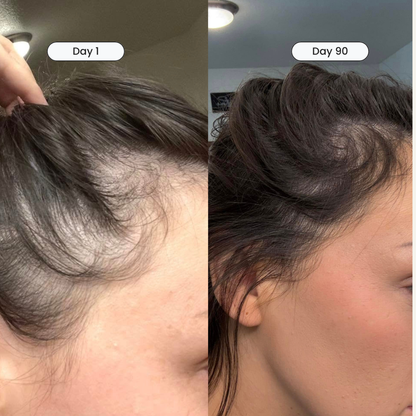 Curescalp™ Hair Revival System